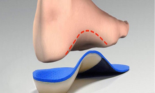 CAD-CAM Milled Insoles